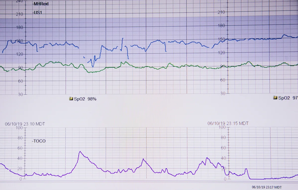 A chart showing sleep health statistics related to heart health and irregular bedtimes A chart showing sleep health statistics related to heart health and irregular bedtimes