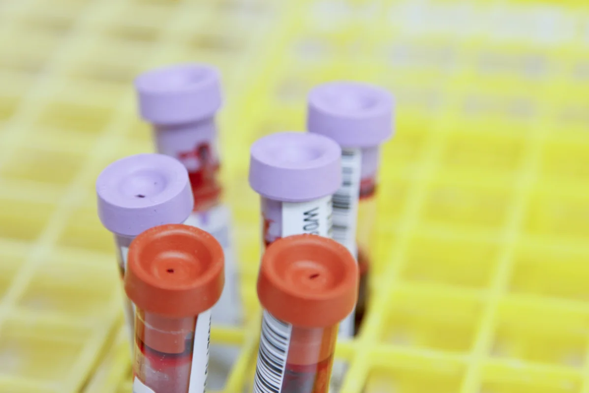 Laboratory equipment for testosterone testing Laboratory equipment for testosterone testing