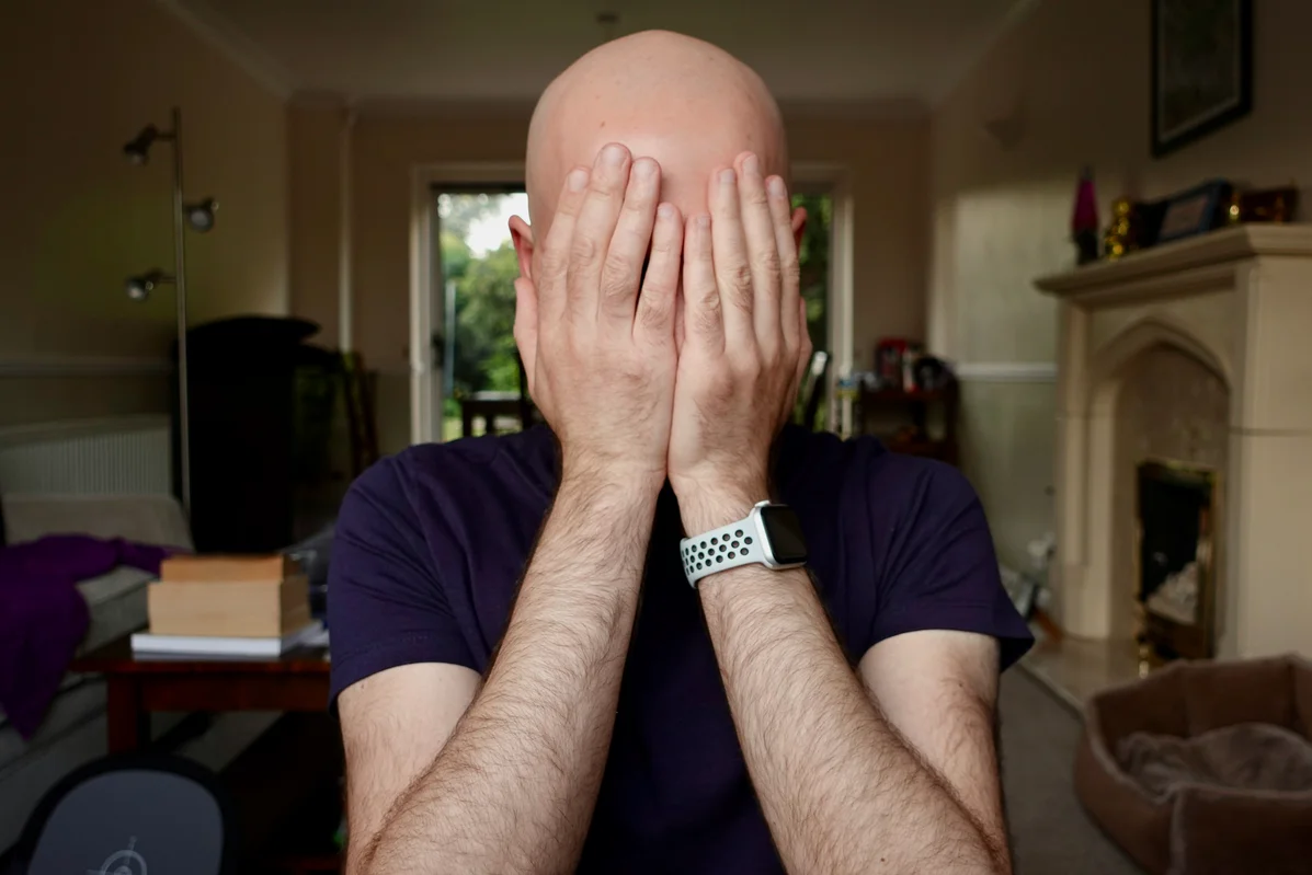 Bald Men: Essential Scalp Care Tips for Healthy Skin